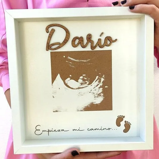 Cuadro personalizado ecografía bebé